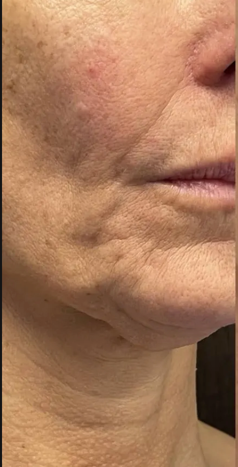 Before using the product