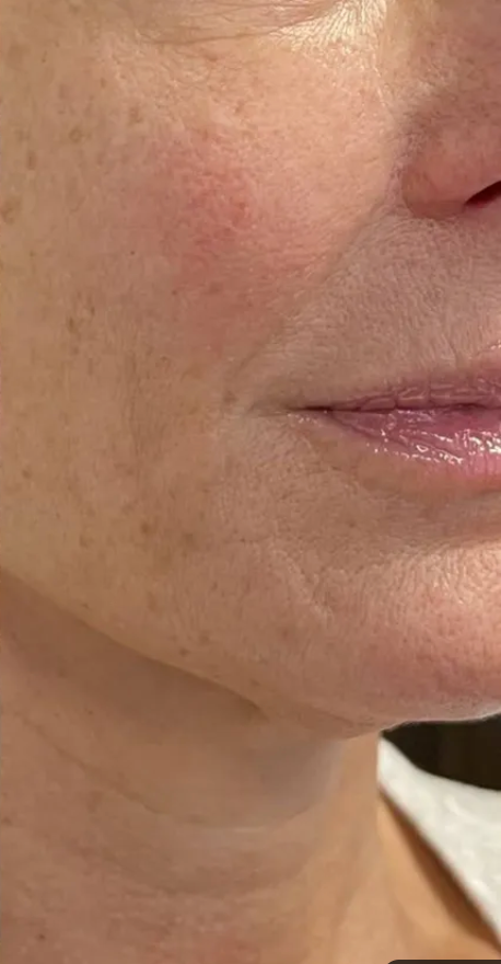 After using the product