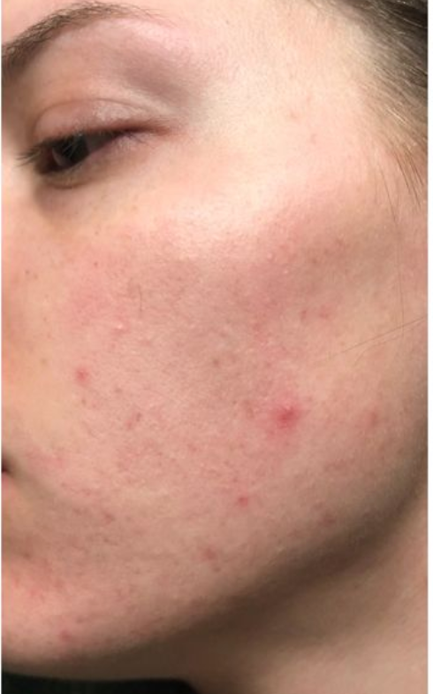 After using the product