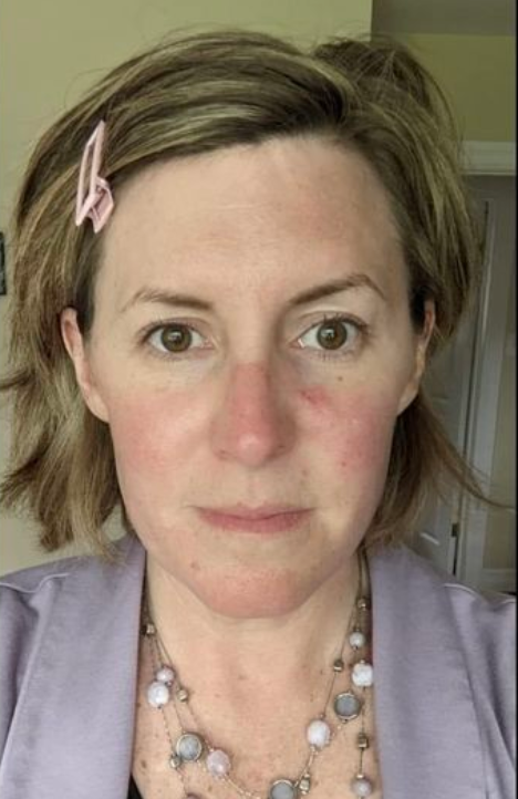 Before using the product