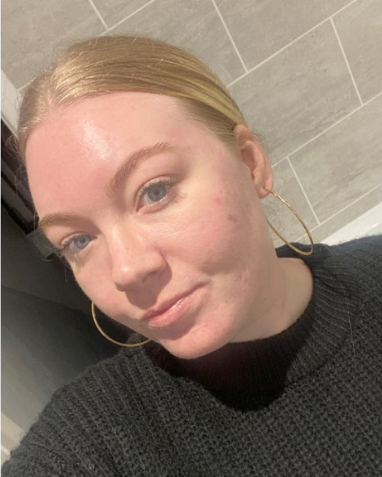 After using the product